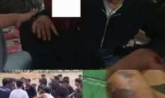 Keluar dari GSG Mahasiswa FP Unila Dikeroyok, Korban Lapor Polisi